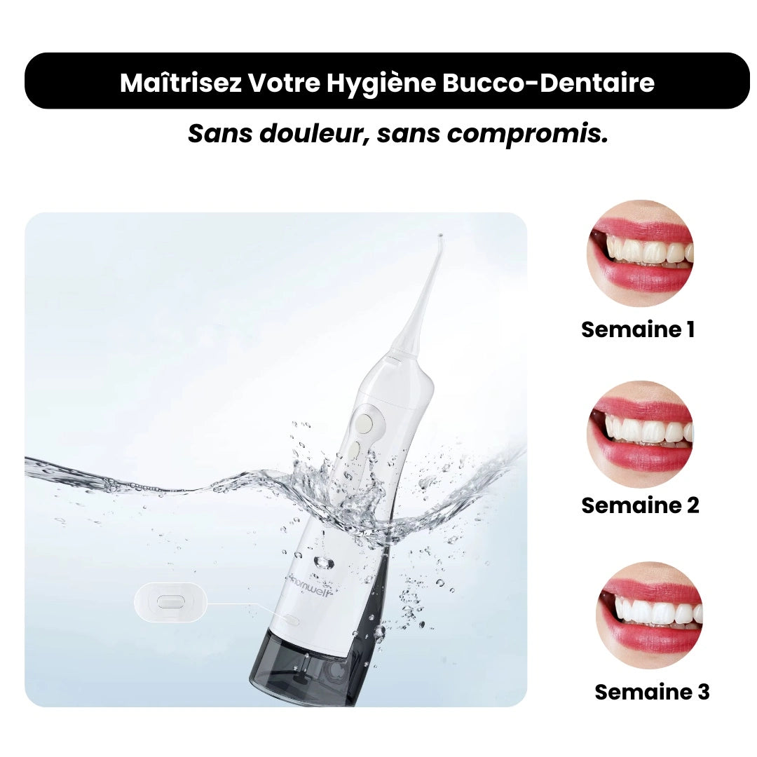 Irrigateur buccal – Hygiène parfaite